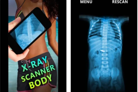 Conheça o aplicativo para simular raio-x no celular